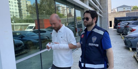 Samsun'da Eski Eşi Darbeden Şüpheli Gözaltında
