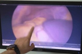 Samsun'da organları ters yerleşen 54 yaşındaki Muzaffer Uzunbacak kitleden kurtuldu