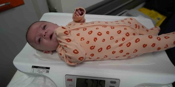 24. haftada doğan bebek, Samsun'da 104 günde 720 gramdan 5 kilo 775 grama ulaştı
